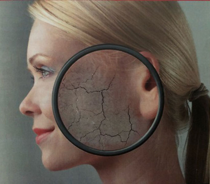 DERMAPLANNING-KUORINTA