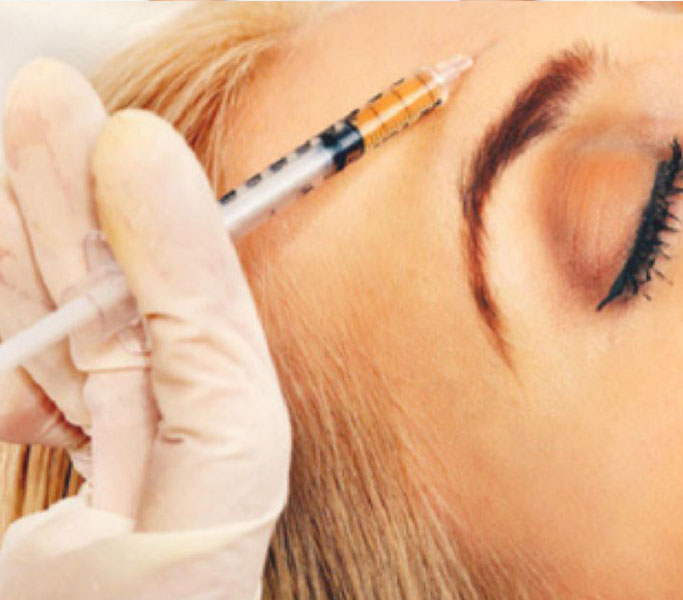 botox-eli-botuliinihoidot-iholle